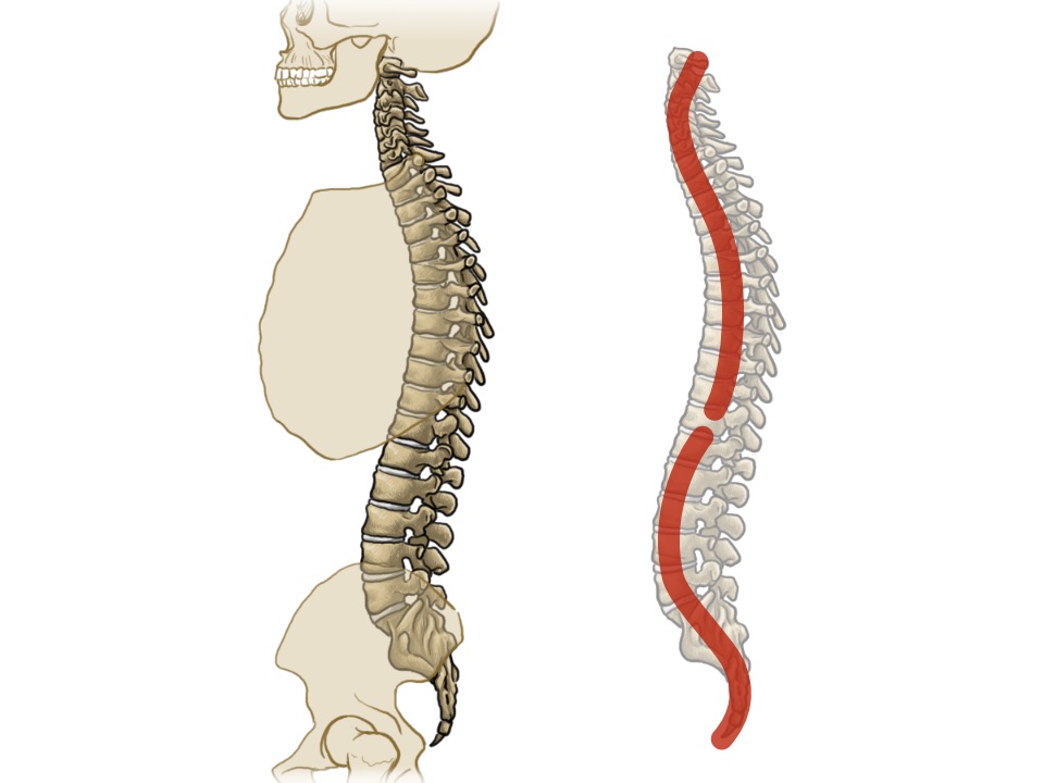 Grafische Abbildungen einer Wirbelsäule von der Seite, einmal links im gesamten Skelett integriert und links alleinstehend mit in rot eingzeichneter Doppel-S-Form.
