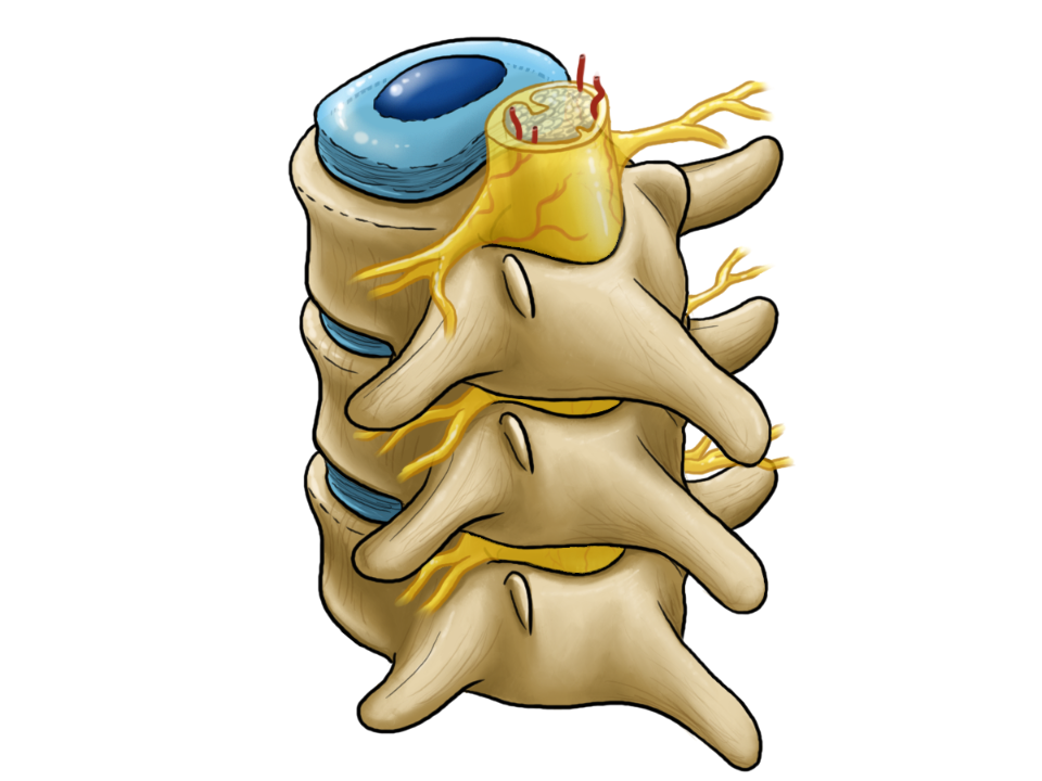 Grafisch dargestellter Wirbel mit farblich markierten Bandscheiben und Rückenmark. Wirbel mit dazwischen liegenden Bandscheiben und dem im Wirbelkanal verlaufenden Rückenmark.