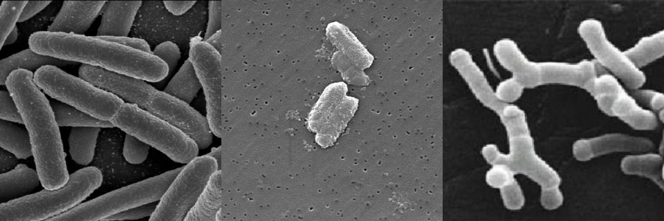 Die stäbchenförmigen Bakterien im menschlichen Darm sehen aus wie lange Würstchen.