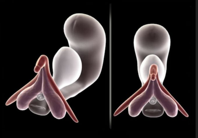 Abbildung vollständige Klitoris